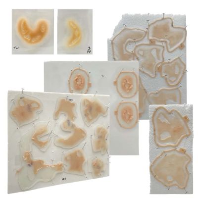 Lot 31: The Last Voyage of the Demeter Captain Eliot (Liam Cunningham) Production Used 5 Deep Bite Wound Prosthetics, 7 Left Hand Burn Wound Prosthetics, 7 Hr Prosthetics & 2 Bite Prosthetics | VIP Fan Auctions