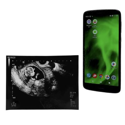 Power Book IV Force Tommy (Joseph Sikora) Screen Used Ultrasound Photo & Phone Ep 302, 307 | VIP Fan Auctions