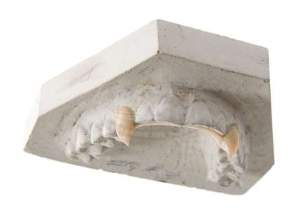 Lot 82 - Blade - Deacon Frost Vampire Fangs (Stephen Dorff)