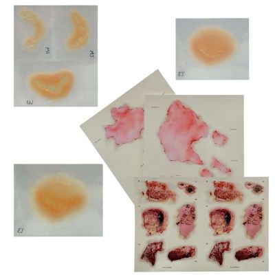 Lot 37: The Last Voyage of the Demeter Toby (Woody Norman) Production Used 5 Bite Prosthetics & 3 Burn Wound Tattoo Sheets | VIP Fan Auctions