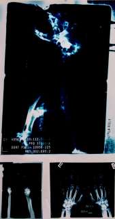 Prop X-rays of Wolverine used in X2 | Blacksparrow