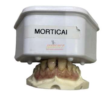 Lot 234 - Mortdecai (2015) - Mortdecai (Johnny Depp) Teeth Appliance On Depp Lifecast