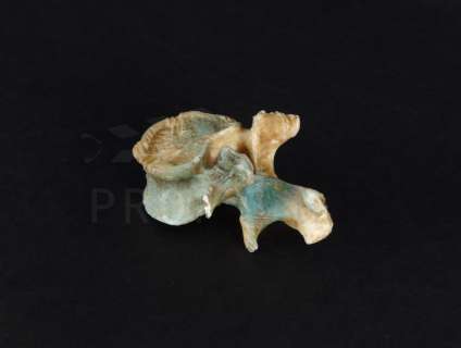 Lot 161 - Bones (20th Century Fox Television, 2005-2017) - Toxic Waste Vertebra S07E09 (0633)