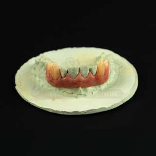 Bram Stoker’s Dracula (1992) | Dracula (Gary Oldman) Fangs on Teeth Cast | Propstore