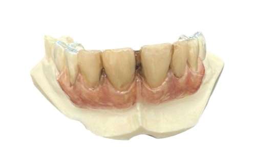 Lot 168 - Mortdecai (2015) - Mortdecai (Johnny Depp) Teeth Appliance On Dental Cast