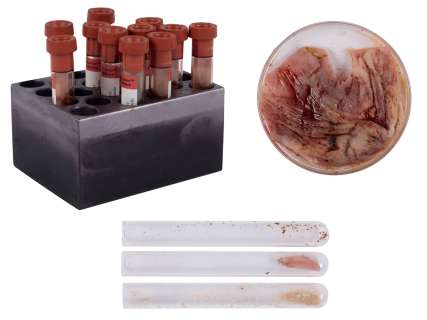 The Walking Dead Edwin Production-Used CDC TS-19 Samples, Petri Dish, Test Tubes, Vials – Season 1 – AMC LOA | Goldin
