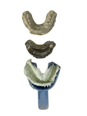 Spider-Man 3 (2007) - Topher Grace (Venom) Prosthetics Teeth Collection | Hanlin Auction Service