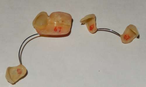 Kelsey Grammar "X-MEN" Film Worn FX Teeth Appliance | Gotta Have Rock and Roll