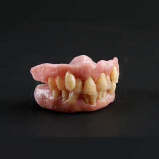 Hannibal - Lot 1249 - SEASON 3 EPISODE 8: "THE GREAT RED DRAGON" Francis Dolarhyde‘s (Richard Armitage) Veneers