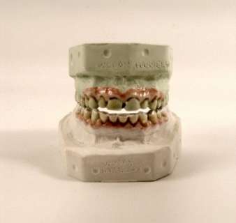 Lot 348 - Out of the Furnace Harlan DeGroat (Woody Harrelson) Facial Appliances