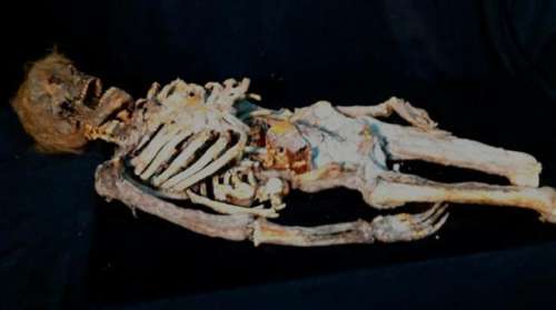 Nip/Tuck (2003-2010) Skeletal Remains | Premiere Props