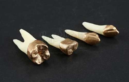 Power Rangers - Lot 175 - Rita Repulsa‘s Gold Teeth Loot