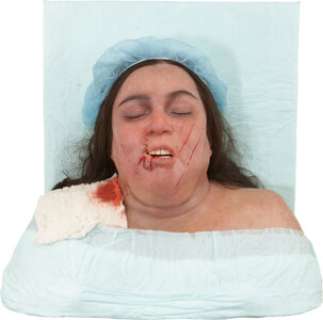 Rosie O‘Donnell Nip/Tuck Surgical Bust....