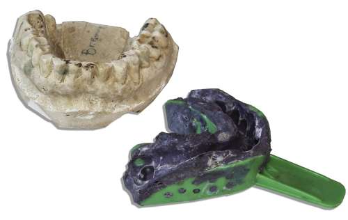 ’’Captain Kangaroo’s’’ Beloved Character, Mr. Green Jeans, Set of Teeth Impressions | Nate Sanders