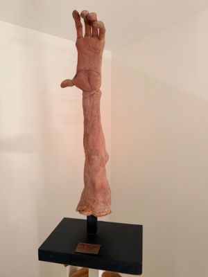 300 film Spartan hero Ephialte Deformed hero arm movie prop