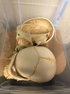 Skull From the School Science Lab from the show- Box of 2 with Removable Cranium and Jaw | Direct Liquidation